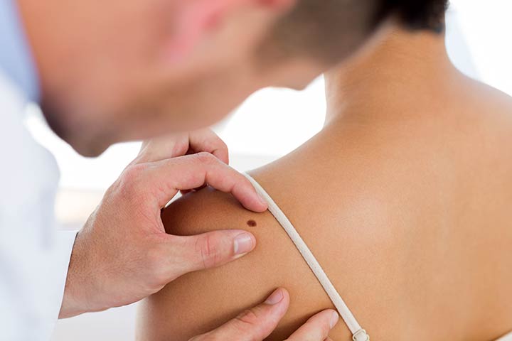 Skin Checks at Newbay Medical